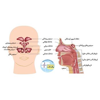 شناخت علائم سینوزیت نقش مهمی در درمان مؤثر دارد